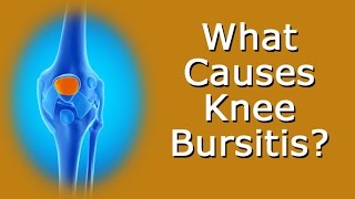 What Causes Knee Bursitis [upl. by Eniamzaj465]