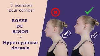 Hypercyphose dorsale  3 exercices pour corriger [upl. by Grey]