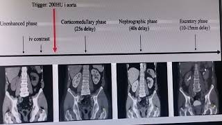 CT SCAN INTERVIEW WITH NCCT KUB CECT KUB UROGRAPHY [upl. by Aleris]