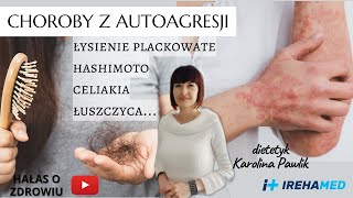 CHOROBY Z AUTOAGRESJI HASHIMOTO WRZODZIEJĄCE ZAPALENIE JELITA GRUBEGO ŁYSIENIE PLACKOWATE [upl. by Abisha]