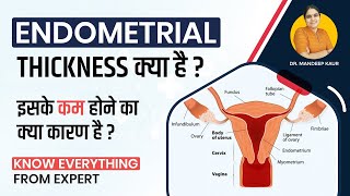 Endometrial thickness Cancer in Hindi Layers ThinEndometrial Hyperplasia Causes Treatment [upl. by Norud]