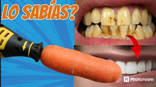 Dientes blancos y limpios en 1 Minuto [upl. by Nareik437]