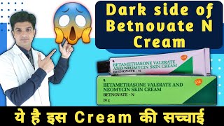 यह है इस क्रीम की सच्चाई  Betnovate n cream awearness  Betnovate n cream [upl. by Trumaine]