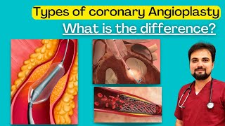 Types of Coronary Angioplasty  Whats the Difference [upl. by Pentha]