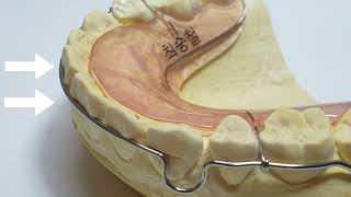 How to apply force to anterior teeth when making a wraparound retainer [upl. by Sirk]