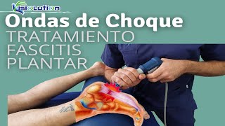 ONDAS DE CHOQUE  TRATAMIENTO FASCITIS PLANTAR con ESPOLON CALCANEO Fisioterapia  Fisiolution [upl. by Ennaer]