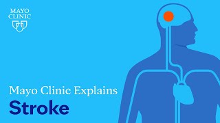 Mayo Clinic Explains Strokes [upl. by Ayet90]