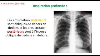 Comment interpréter une radiographie thoracique de face  Partie 1 [upl. by Nahej969]