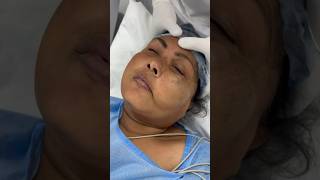 Huge Hemangioma lady goes under Anesthesia [upl. by Anoel835]