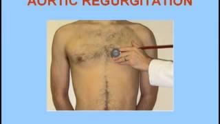 Aortic Stenosis vs Aortic Regurgitation [upl. by Sadie]