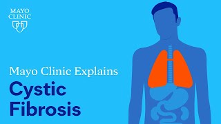 Mayo Clinic Explains Cystic Fibrosis [upl. by Eniar]