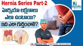 హెర్నియా లక్షణాలు  Complications of Not Treating Hernia  Hernia Symptoms Telugu  Dr Abhilash Nali [upl. by Cathlene]