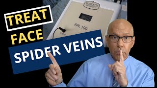 Learn How To Remove Spider Veins on the Cheeks Chin and Nose A Guide for Doctors and Nurses [upl. by Stig]