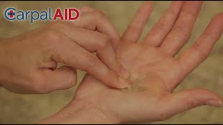 CarpalAID®  Small Patch Big Relief Carpal Tunnel Syndrome Relief [upl. by Ennahtur]