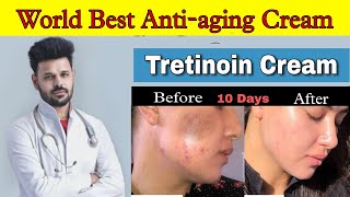 Tretinoin 0025 cream review  Retino A 0025cream Review  tretinoin cream 0025 before and after [upl. by Oneill]