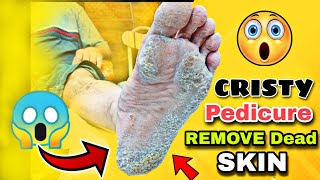 Perfect Pedicure at Home Nail Care Tips and Tricksquot [upl. by Aihsik]