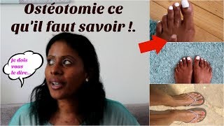 Ostéotomie des pieds mon opération douloureuse 2ème partie [upl. by Earaj]