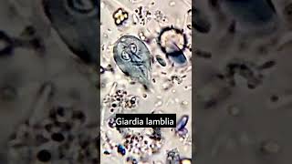 Giardia lambliaGiardiasis parasiteparasite under microscope microscopy parasitology [upl. by Hilar761]