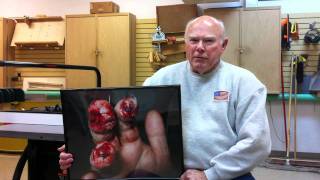 SawStop  Craig B describes his table saw injury [upl. by Shaddock259]