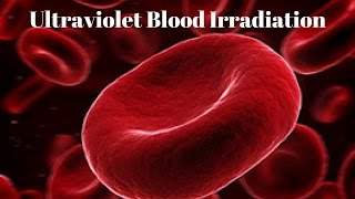 Ultraviolet Blood Irradiation [upl. by Jocelyn113]