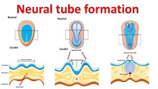 neural tube formation  Embryology  Neurulation [upl. by Winola]