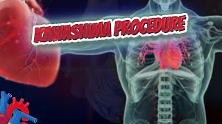 Kawashima procedure  Human Heart and Cardiology ❤️❤️❤️🔊✅ [upl. by Ahsote]