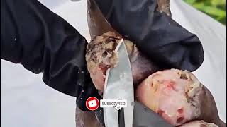 How to remove jigger digging from leg part 2 [upl. by Tasiana]