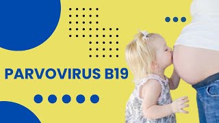 Parvovirus B19 Infection  Fifth Disease  Clinical Features Diagnosis and Management [upl. by Jangro]