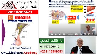 Diabetes Mellitus 1 Introduction cme internalmedicine medical usmle محاضراتباطنة [upl. by Hsan]