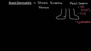 Stasis Dermatitis Part 1 [upl. by Quinton613]