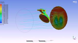 CFX Simulation of a Rigid Body around a custom axis  Velocity Pathlines [upl. by Entsirhc214]