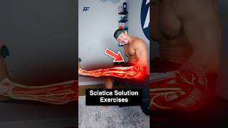 3Step Sciatica Fix [upl. by Cammy]