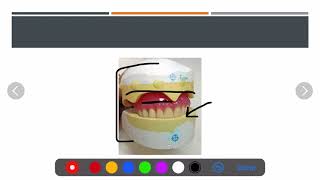 216 Prosthodontics Relining Repairing and Rebasing [upl. by Simdars992]