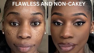 PITTED ACNE SCAR MAKEUP TUTORIAL STEP BY STEP ICEPICK SCARSBOXCAR SCARSCRATERS [upl. by Arykahs921]