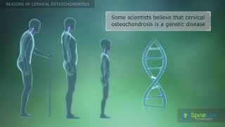 Cervical osteochondrosis Reasons [upl. by Ratha]