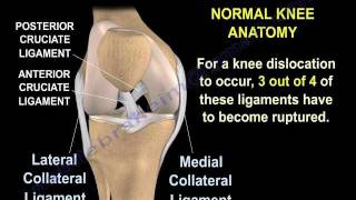 Knee Dislocations  Everything You Need To Know  Dr Nabil Ebraheim [upl. by Treiber]