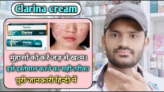 Clarina cream use benefits and Side effects full review in hindi [upl. by Akirderf]