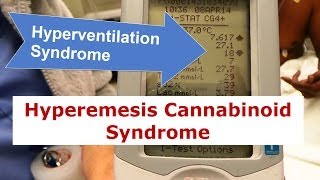 Hyperventilation Syndrome and Hyperemesis Cannabinoid Syndrome [upl. by Ainival185]