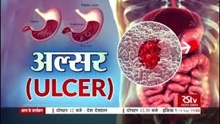 Ayushman Bhava  अल्सर  Ulcer [upl. by Yeniffit]