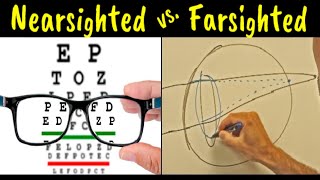 Myopia vs Hyperopia vs Presbyopia  Difference Explained [upl. by Nemrac703]