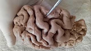 NEUROANATOMY  CEREBRAL CORTEX PART1 SULCI AND GYRI  BY DR MITESH DAVE [upl. by Flieger]