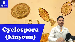 Conoce a Cyclospora cayetanensis con tinción de KINYOUN [upl. by Ramilahs]