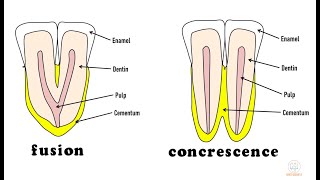 developmental disturbances of teeth  neet mds [upl. by Dnarud]