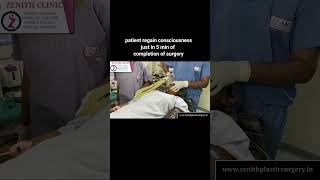 GENERAL ANAESTHESIA IN SURGERY ANAESTHESIA FOR RHINOPLASTY AND BREAST SURGERYZENITH CLINIC INDIA [upl. by Bigelow34]