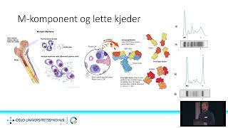 Hva er myelomatose og hvordan behandles det i Norge [upl. by Kavanagh]