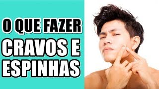 🔴 O QUE FAZER COM AS ESPINHAS E CRAVOS feat EI ANDREW  PELE MASCULINA [upl. by Matthews982]