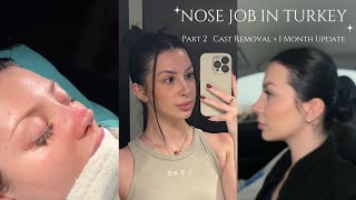 I Got a RHINOPLASTY in Turkey Part 2  Cast Removal  Nose Job 1 Month Update  Dr Sedat Ruzgar [upl. by Eisenberg535]