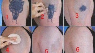 How to Remove a Tattoo without Laser at Home [upl. by Hsirap]