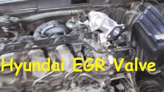 Hyundai Sonata EGR problem  EGR Valve replacement Hyundai EGR Cleaning [upl. by Attener]