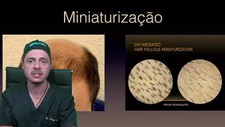 Precisa tomar finasterida após o transplante capilar  Dr Thiago Bianco [upl. by Cyrille]